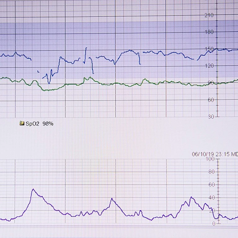 Permixon : tout ce que vous devez savoir sur ce traitement de l'hypertrophie bénigne de la prostate